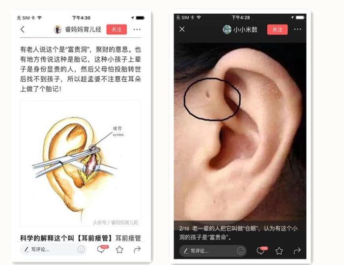 开头的部分,提取中心思想就是"孩子耳朵旁有这样小洞"这句话你随便用