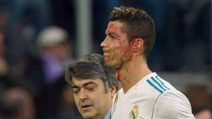 c罗血染赛场!遭对手鞋钉爆头,起身后竟先找手机玩"自拍"