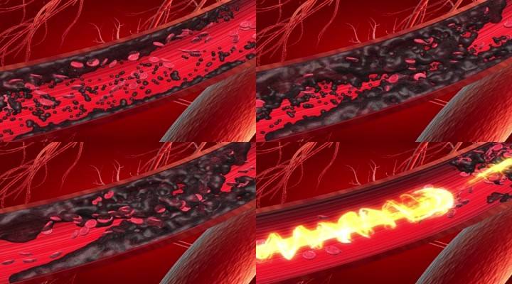 常吃2种食物,血管通畅到老