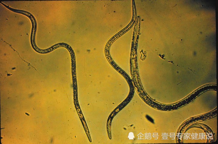 很多人都爱吃它,却不知道里面或藏有寄生虫,看完你还敢吃?