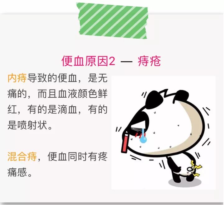便血?肠癌还是痔疮?快来对照一下!