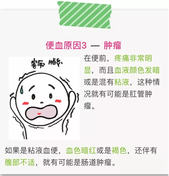 便血肠癌还是痔疮快来对照一下