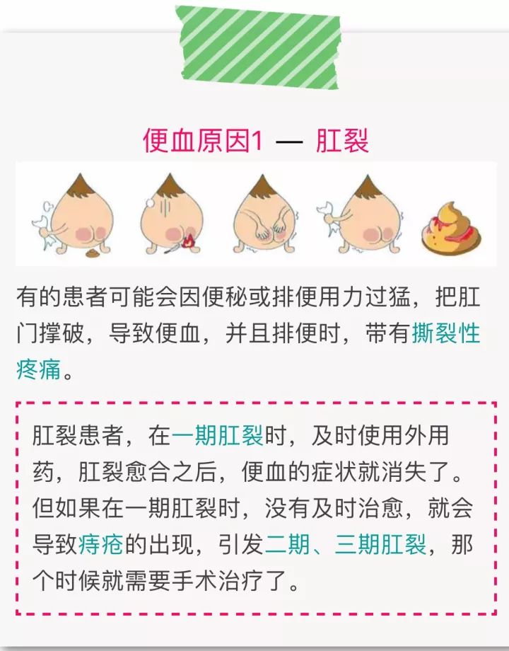 便血?肠癌还是痔疮?快来对照一下!