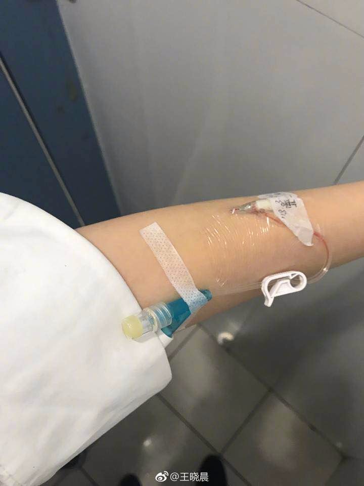 王晓晨带病工作 打点滴出席活动