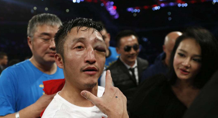 拳坛荣誉拿命来换,眼睛曾被打成血馒头