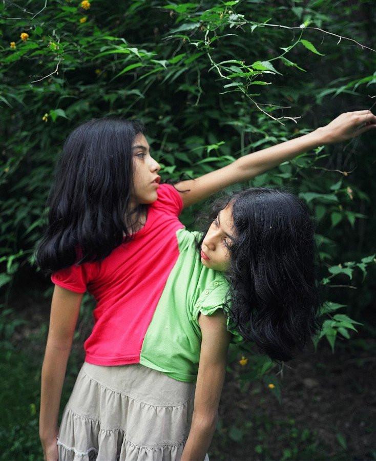 连体姐妹的生活, 进入大学并希望成为兽医, 有自己的孩子