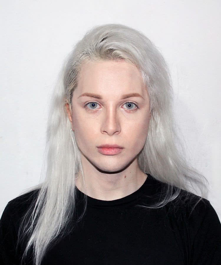 包括:下巴抽脂,隆鼻,注射肉毒素,全身脱毛,皮肤激光漂白,甚至包括医学