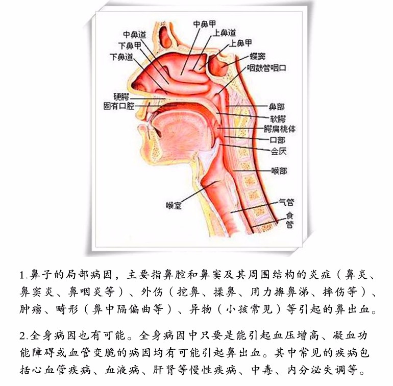 揭密流鼻血你做过的假操作处理不慎容易引发窒息
