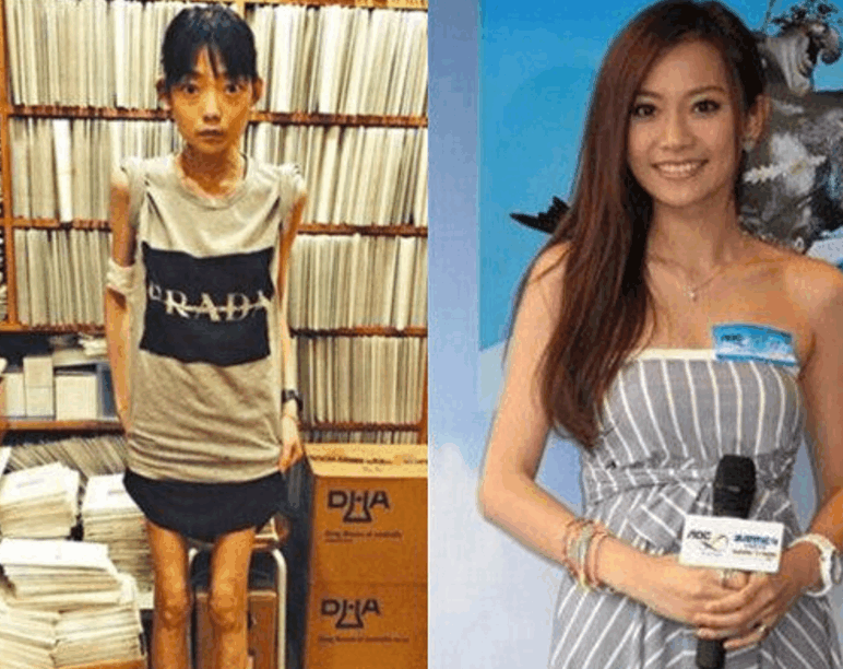 成功嫁入豪门, 却被人戏称为史上最惨正宫, 还被病魔折磨全身瘫痪