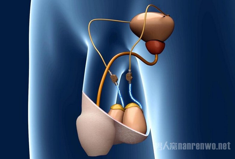 德国木匠发明"精子开关"想开就开想关就关无需结扎
