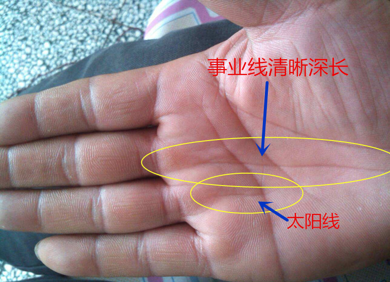 手相|太阳线|财富_新浪新闻