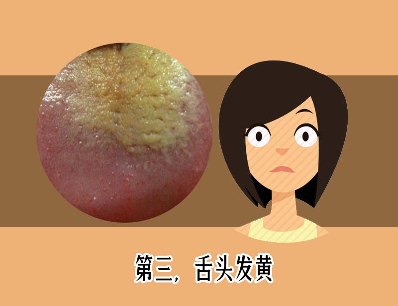 舌苔发红发黑是疾病警告？医生教你如何从舌头颜色看出哪病了?