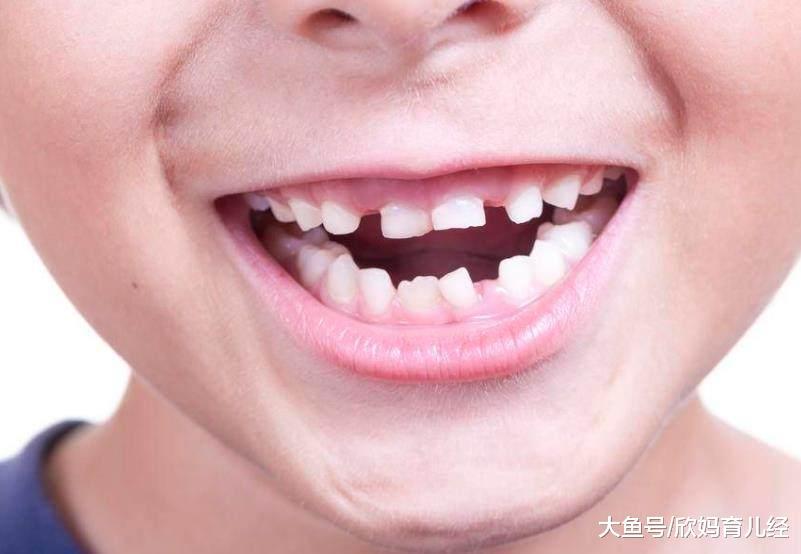 妈妈要留心这些事情, 缓解宝宝出牙期的不适|宝宝|妈妈|牙龈_新浪新闻