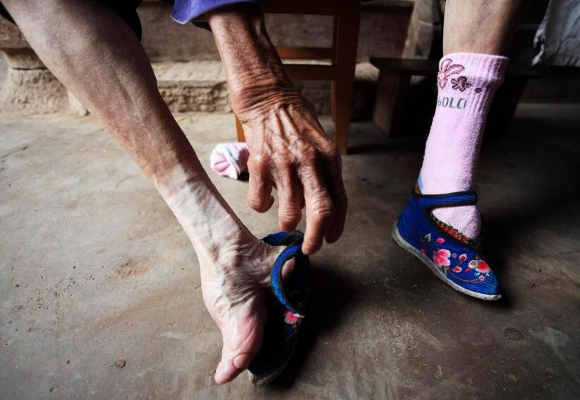 那些年的裹脚老人,这才是原始的小脚太太,最后一张让人不忍直视|太太|