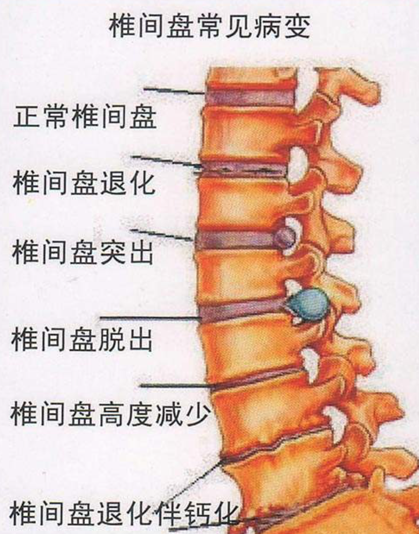 第二腰椎位置图图片