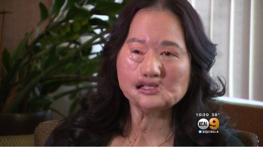 28岁时她被丈夫严重家暴,戴了12年面具,孩子只能听声音认她