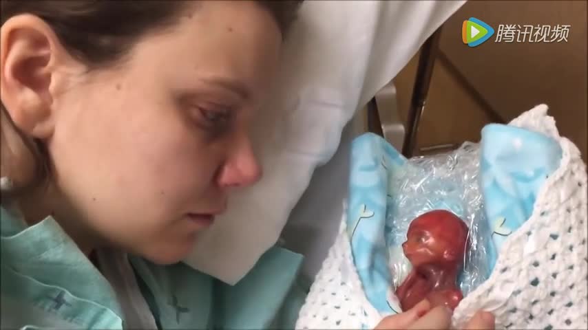 她是世界上最小的婴儿:出生时仅19周 只活了几分钟