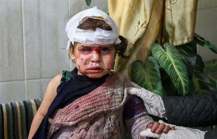 叙利亚战争饥饿图片