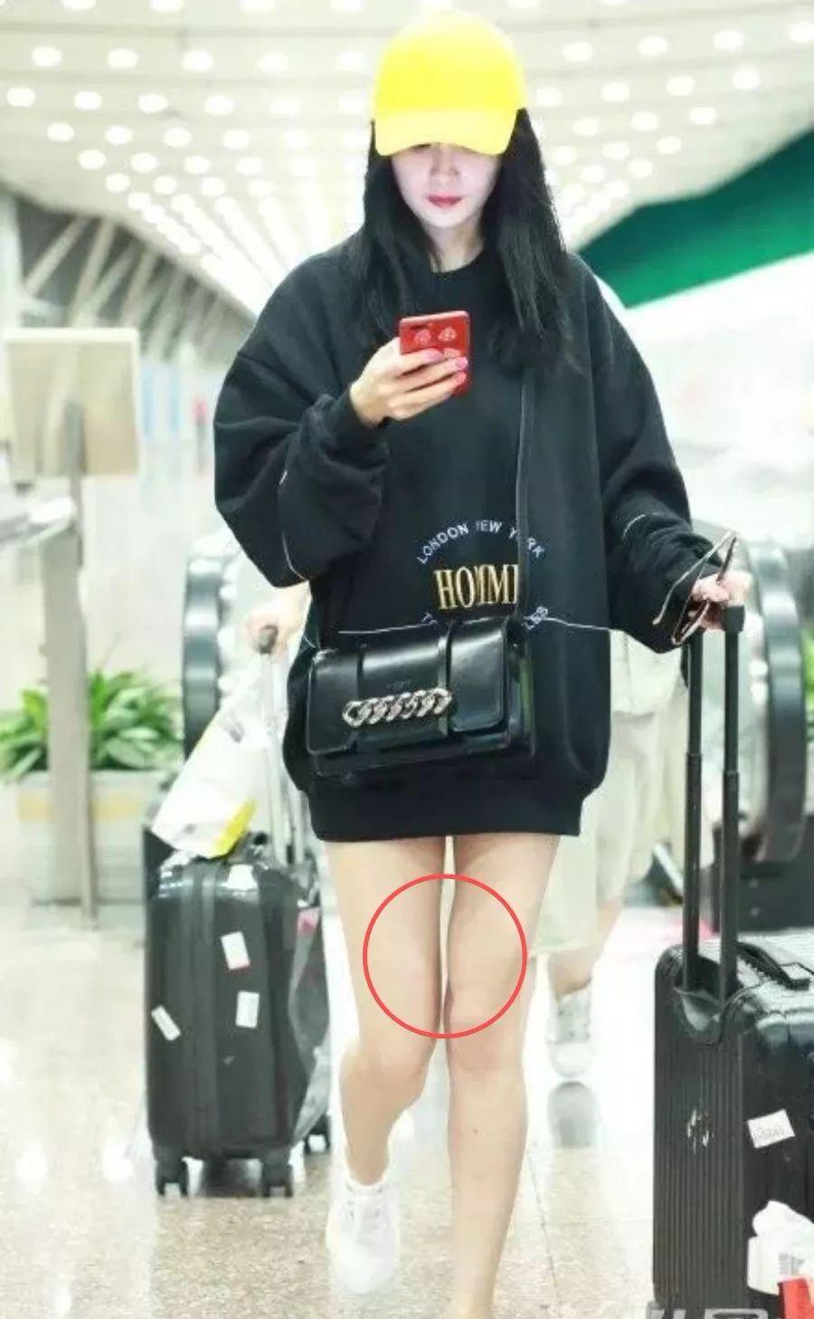 杨幂这没修过的腿是漫画腿还是畸形腿心里没点数么