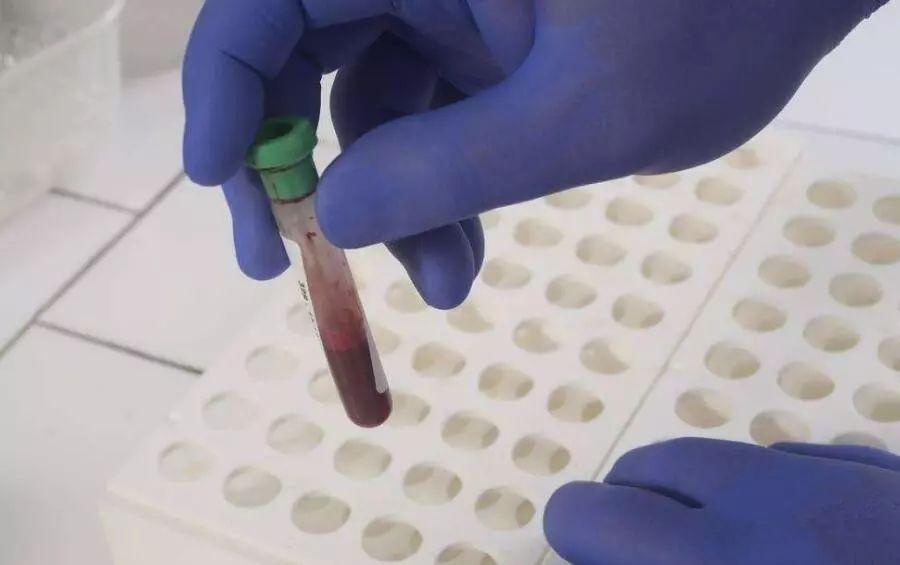 采血管|抽血|血量_新浪网