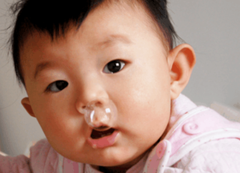 孩子流鼻涕已经拖拖拉拉有二十天了,当时都没有在意,所以就一边上幼儿