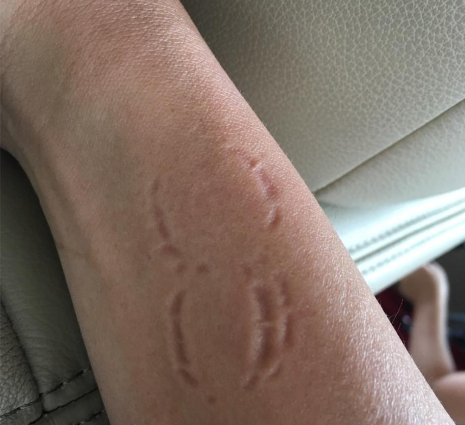 农村女孩专门咬人挣钱, 月入十万全靠嘴好牙, 咬一口不知有多舒坦