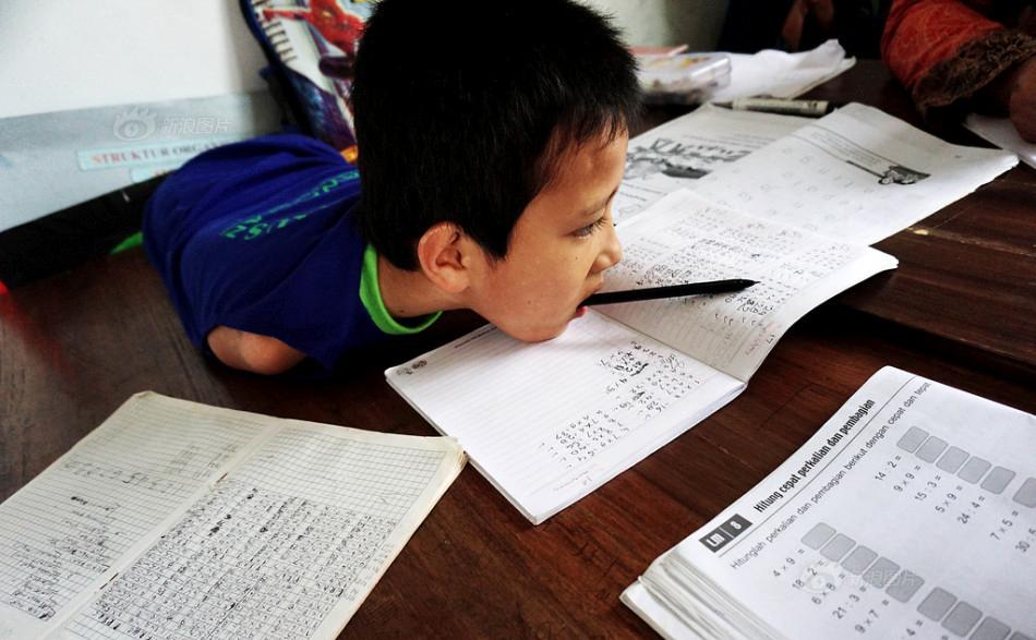 印尼11岁男孩天生无手无脚,成绩优异激励无数人!