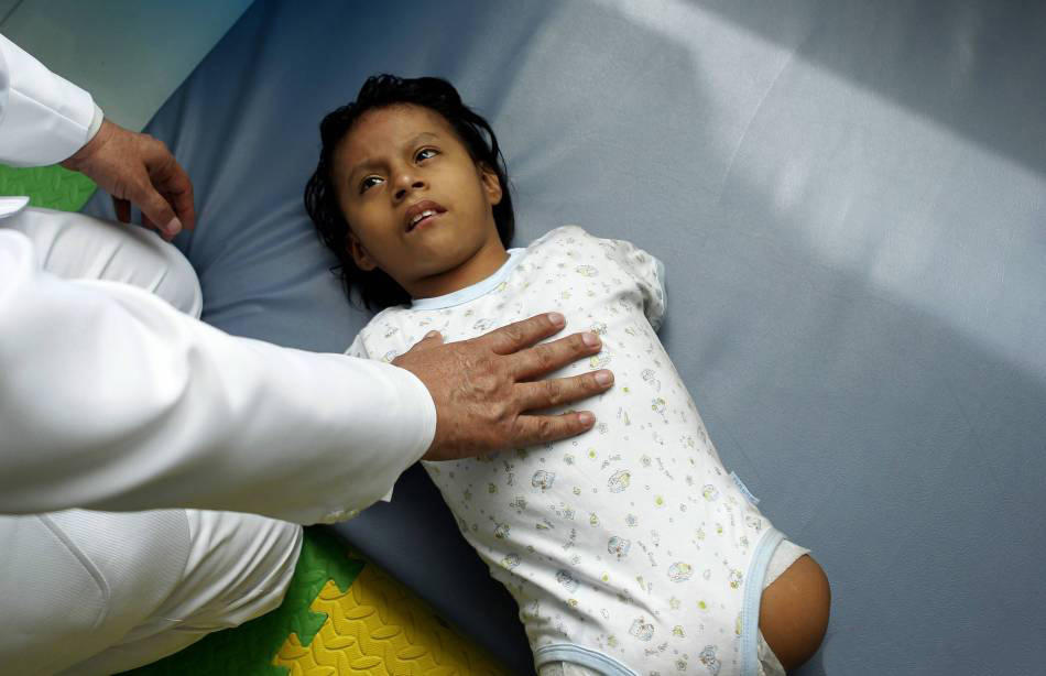 直击8张罕见的四肢全无女孩的催泪照