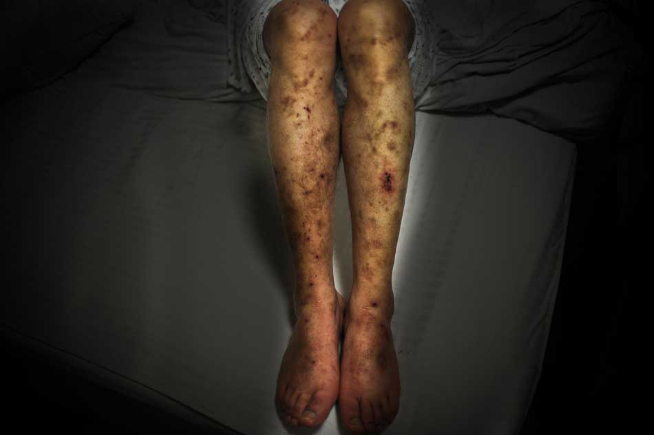 如何做到科学戒毒?