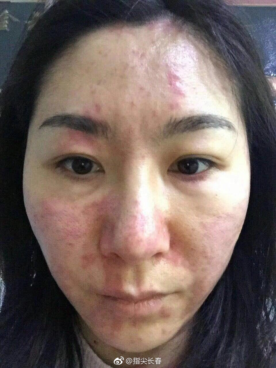 怀疑甲醛中毒,学生冬季开窗散味儿|过敏|甲醛|学生_新浪新闻