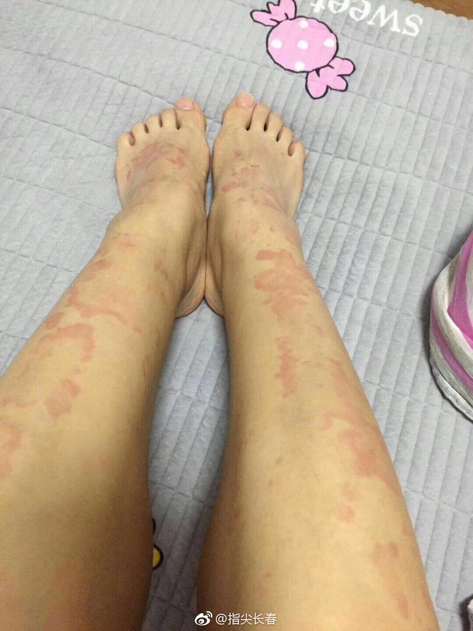 怀疑甲醛中毒,学生冬季开窗散味儿