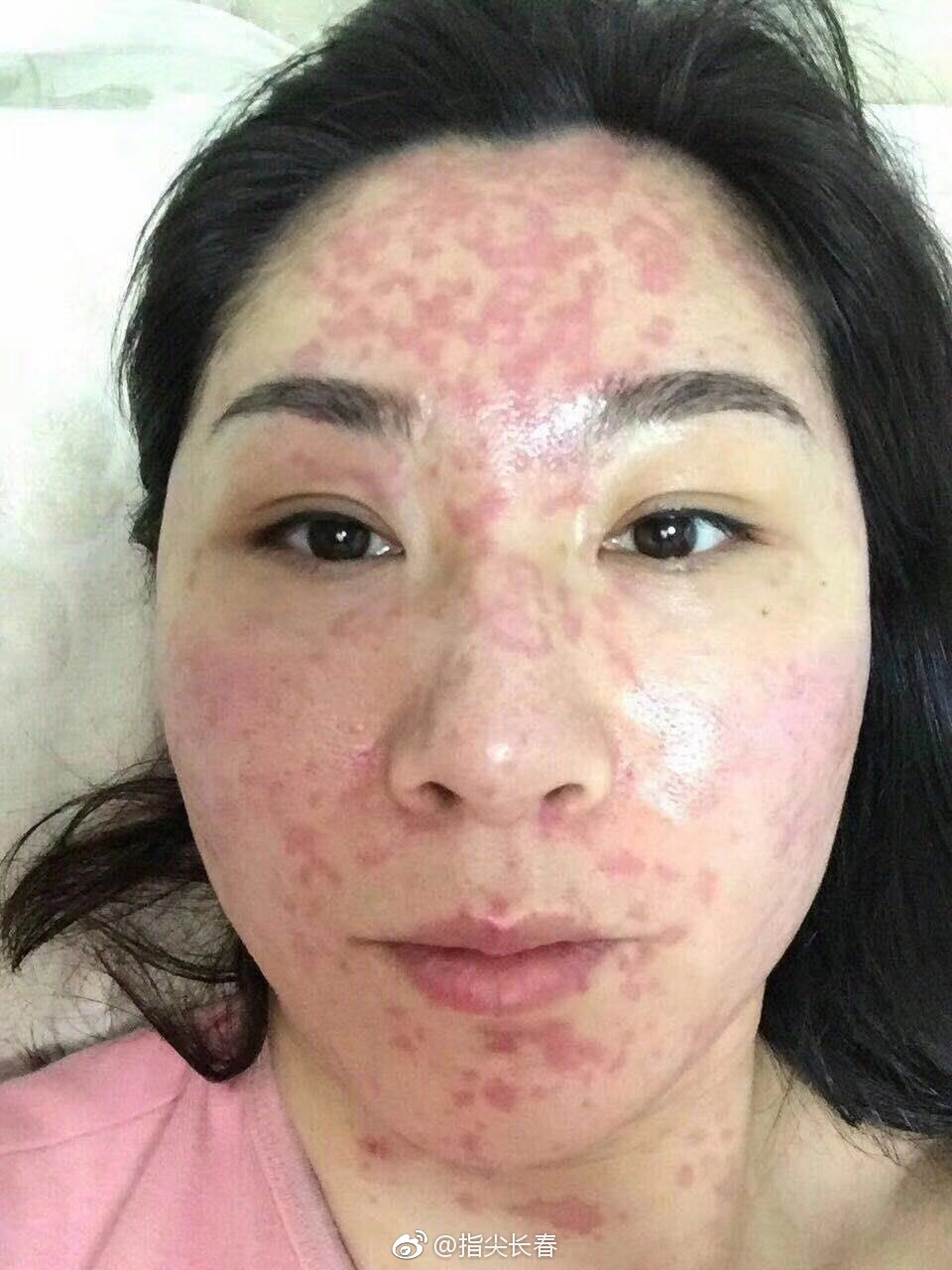 怀疑甲醛中毒,学生冬季开窗散味儿