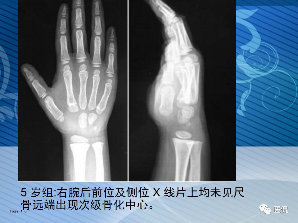 x光看未成年人上肢骨化中心的出现时间#医学影像经典ppt