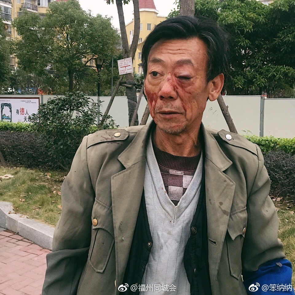 气愤!因不满卖地瓜老人称重 年轻男子出手伤人