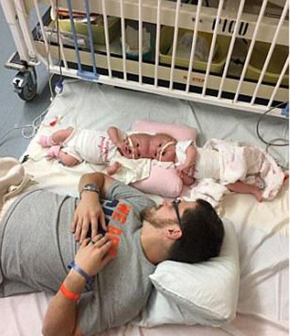 准妈妈|医生|连体婴_新浪新闻