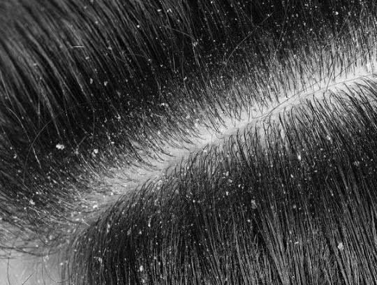 头上出现4信号暗示剪发虫已布满头顶再不清除发根将被它啃烂