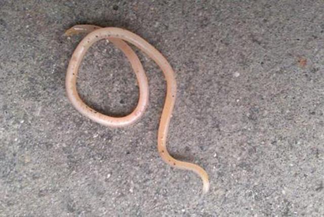 家长别大意孩子出现这5个症状就是肚子里长蛔虫了