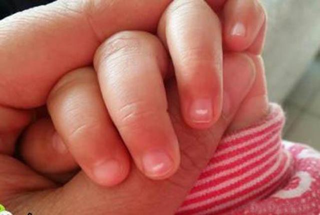 家长别大意孩子出现这5个症状就是肚子里长蛔虫了