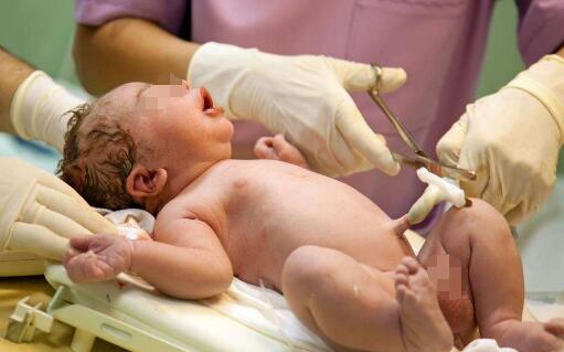 婆婆不同意剖腹产