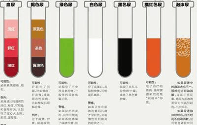 若喝水量没有变化,但尿量骤减或增加时,或年龄小于60岁的正常人,在