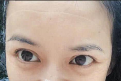 近日,好久不见的陈意涵终于发博,还配上了一张照片,但网友却问:额头上