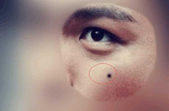 这六处长痣的男人最克妻,性格霸道怪癖多,既克妻财,又克妻命!