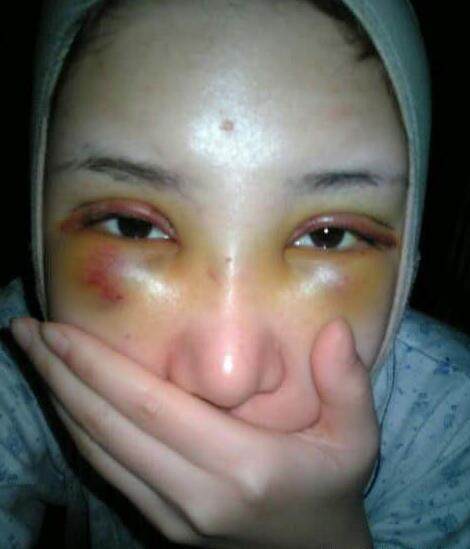 为追星疯狂整容的五位星迷范爷版的最成功刘亦菲版的不堪入目