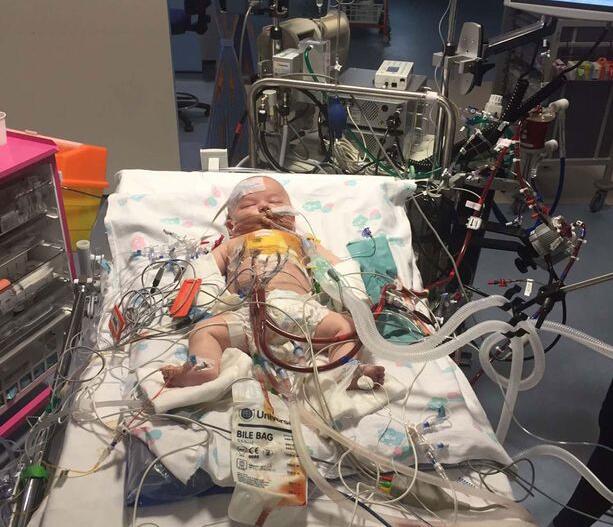 手术中小男婴心脏停跳15小时,依然微笑挺过难关奇迹生还!