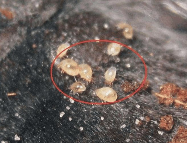 毛孔"聚积"螨虫, 脸上4个部位会说话, 常用3招快速除螨