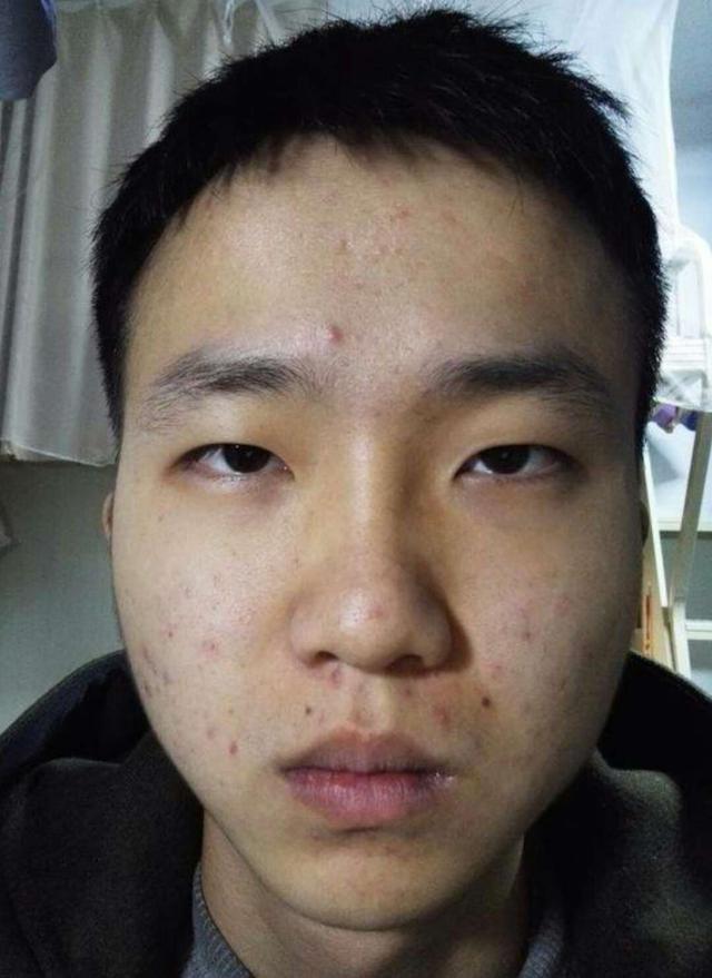 碰到此处长痣的人切记不可小看将来必是人中龙凤超准