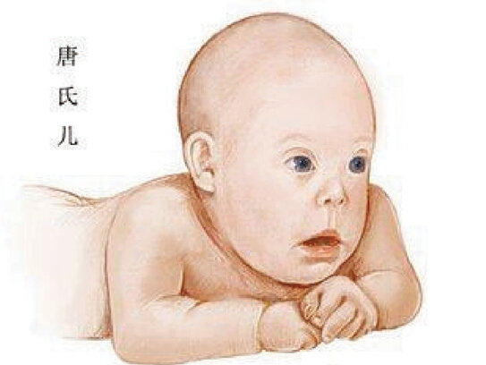 就这么生下了一个孩子,可是孩子出生后她真的是好后悔,孩子是个唐氏儿