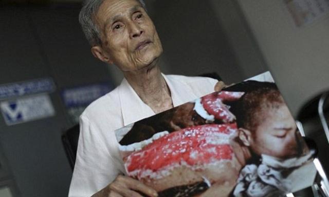 广岛原子弹爆炸后,没有一个记者敢去采访,幸存者究竟说了什么?