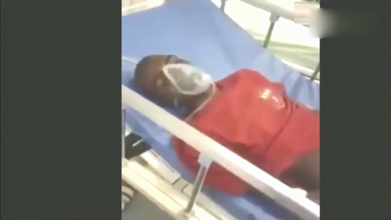 女子与狗同吃同睡,三个月后肚子疼,检查结果令