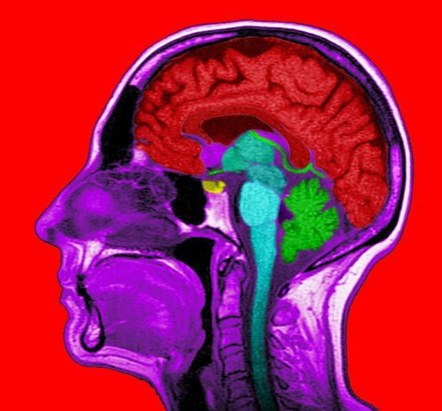 得了脑垂体微腺瘤该怎么治疗才好